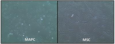 A Comparison of Phenotypic and Functional Properties of Mesenchymal Stromal Cells and Multipotent Adult Progenitor Cells